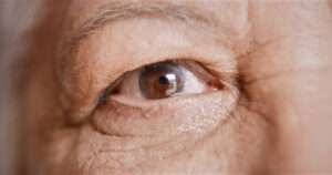 Eye Diseases: A Comprehensive Guide to Protecting Your Vision