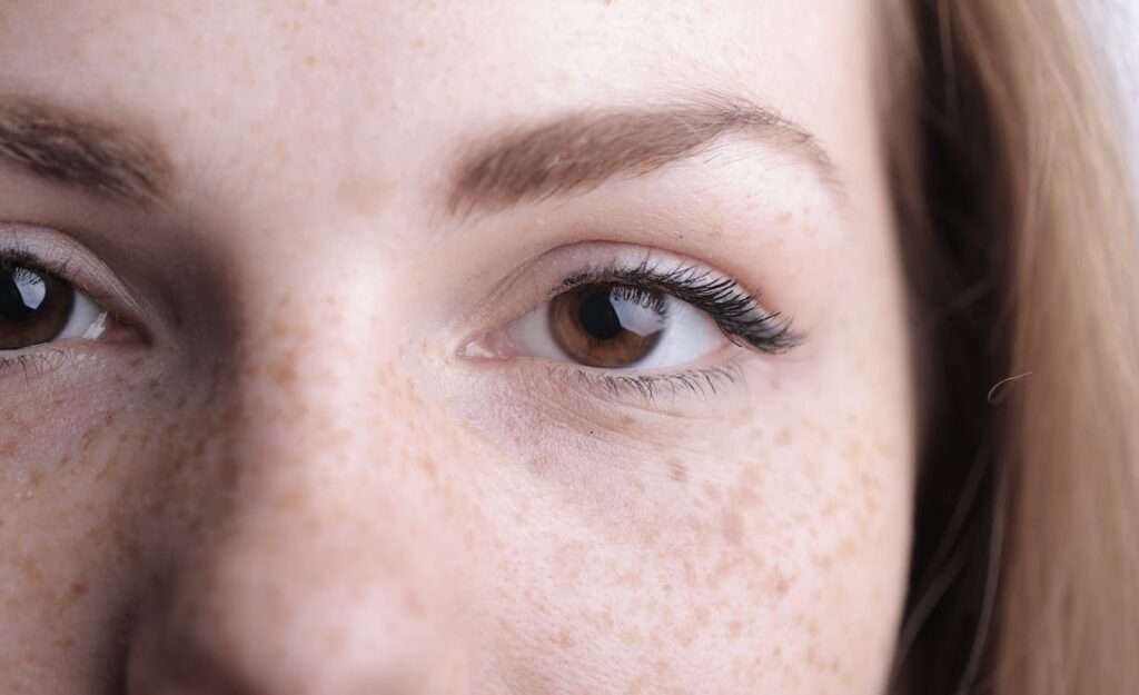 Dry Eyes: Causes, Symptoms, and Effective Remedies