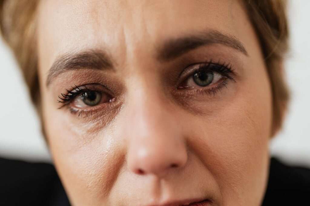 Watery Eyes: Causes, Symptoms, and Remedies