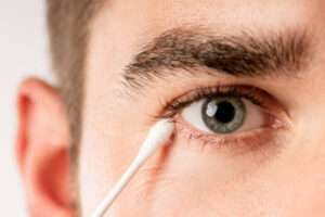 Eyelid Hygiene