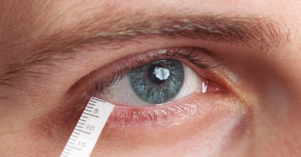 Dry Eye Test in Oakville | Rebecca Optical